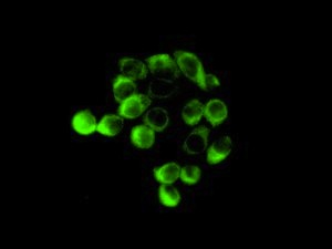 Immunocytochemistry/ Immunofluorescence - Anti-Ube4a antibody [EPR7331] (AB128861)
