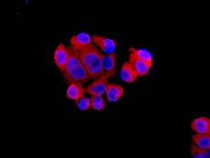 Immunocytochemistry/ Immunofluorescence - Anti-Ube4a antibody [EPR7332] (AB137074)