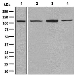 Western blot - Anti-Ube4a antibody [EPR7332] - BSA and Azide free (AB248800)