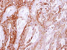 Immunohistochemistry (Formalin/PFA-fixed paraffin-embedded sections) - Anti-UBE4B antibody (AB97697)
