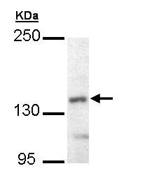 Western blot - Anti-UBE4B antibody (AB97697)