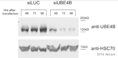 Western blot - Anti-UBE4B antibody [EPR7471] (AB126759), expandable thumbnail