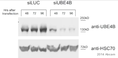 Western blot - Anti-UBE4B antibody [EPR7471] (AB126759)