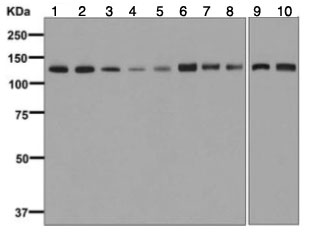 Western blot - Anti-UBE4B antibody [EPR7471] - BSA and Azide free (AB248171)