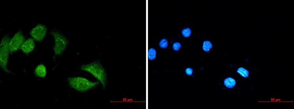 Immunocytochemistry/ Immunofluorescence - Anti-UBE4B Antibody [S04-6C6] (AB317434), expandable thumbnail