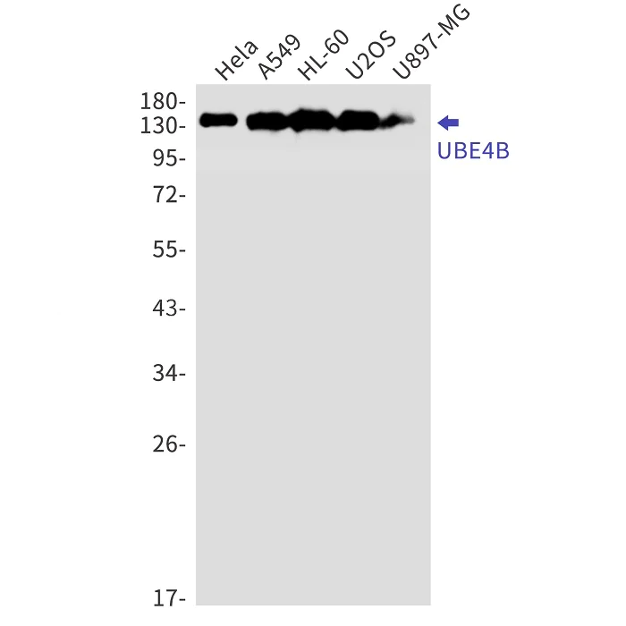 Western blot - Anti-UBE4B Antibody [S04-6C6] (AB317434)