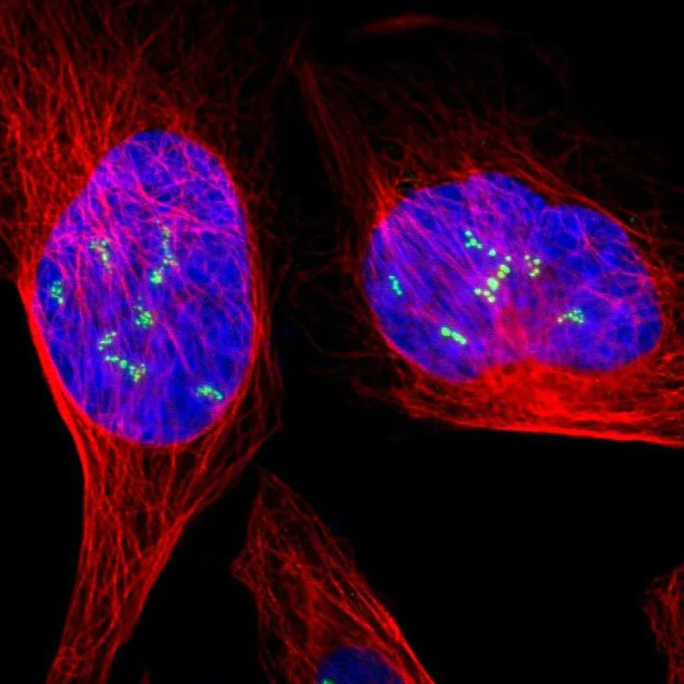 Immunocytochemistry/ Immunofluorescence - Anti-UBF1 antibody (AB244287)