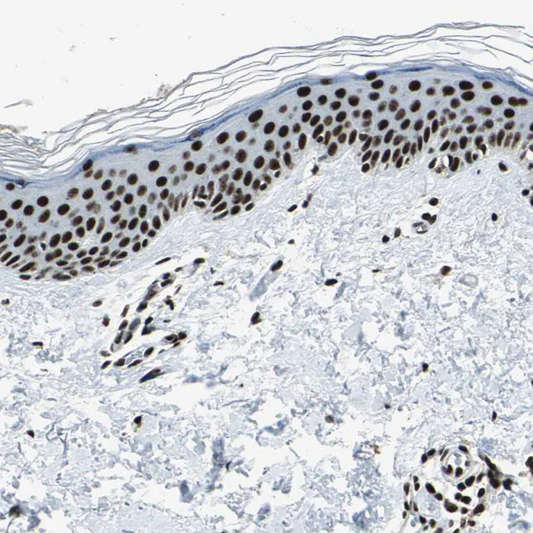 Immunohistochemistry (Formalin/PFA-fixed paraffin-embedded sections) - Anti-UBF1 antibody (AB244287)
