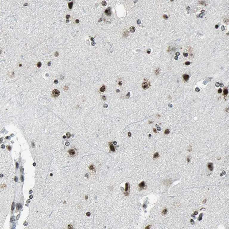 Immunohistochemistry (Formalin/PFA-fixed paraffin-embedded sections) - Anti-UBF1 antibody (AB244287)