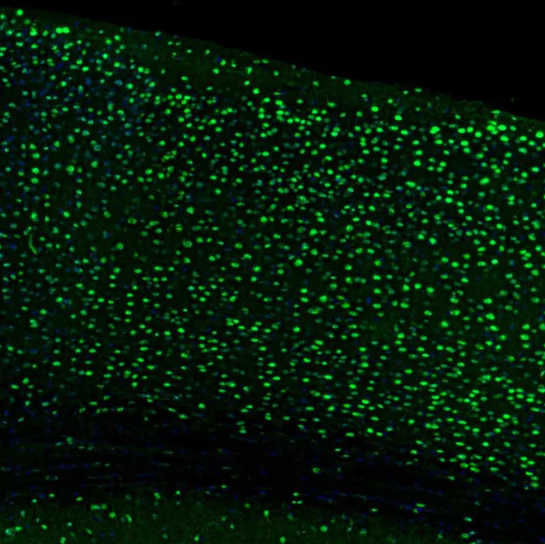 Immunohistochemistry (Formalin/PFA-fixed paraffin-embedded sections) - Anti-UBF1 antibody (AB244287)