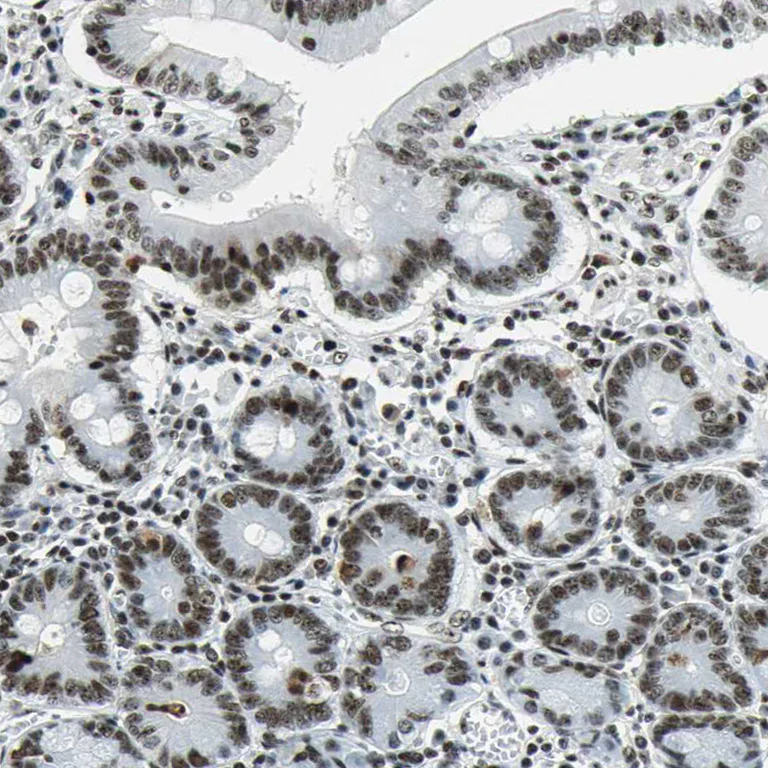 Immunohistochemistry (Formalin/PFA-fixed paraffin-embedded sections) - Anti-UBF1 antibody (AB244287)