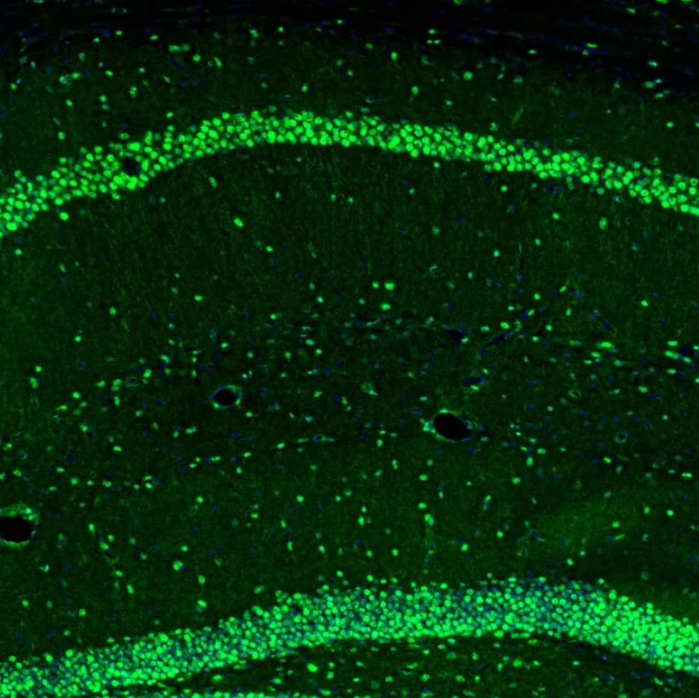 Immunohistochemistry (Formalin/PFA-fixed paraffin-embedded sections) - Anti-UBF1 antibody (AB244287)