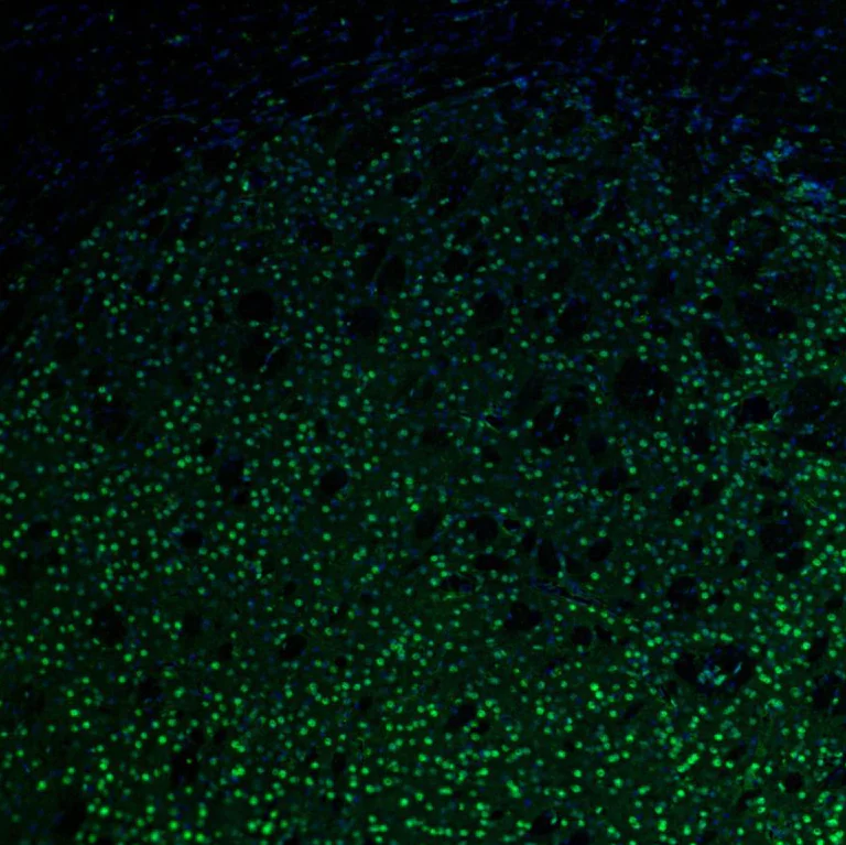 Immunohistochemistry (Formalin/PFA-fixed paraffin-embedded sections) - Anti-UBF1 antibody (AB244287)