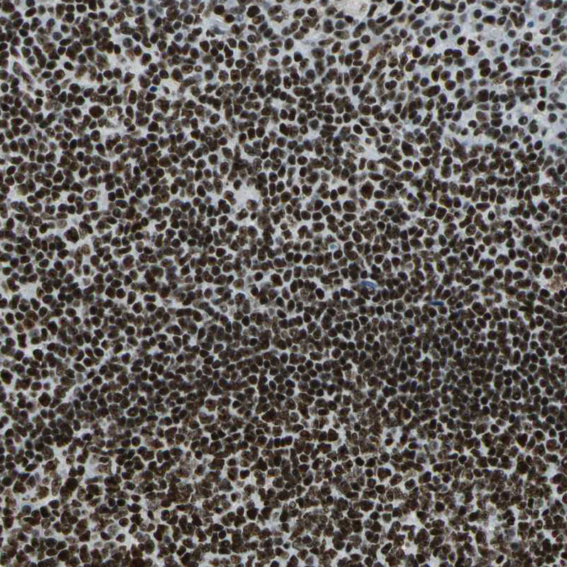 Immunohistochemistry (Formalin/PFA-fixed paraffin-embedded sections) - Anti-UBF1 antibody (AB244287)