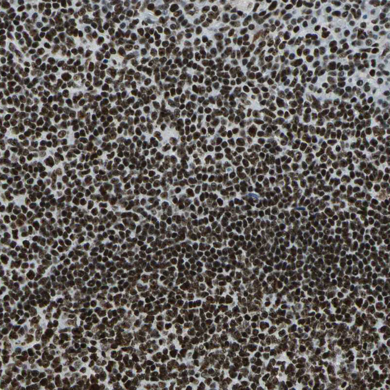 Immunohistochemistry (Formalin/PFA-fixed paraffin-embedded sections) - Anti-UBF1 antibody (AB244287)