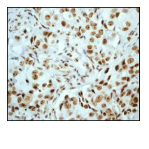 Immunohistochemistry (Formalin/PFA-fixed paraffin-embedded sections) - Anti-UBF1 antibody [EP2741Y] (AB75781)