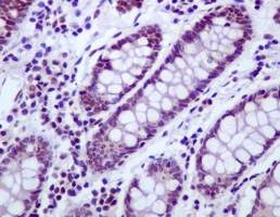 Immunohistochemistry (Formalin/PFA-fixed paraffin-embedded sections) - Anti-UBF1 antibody [EPR2742] (AB109011)