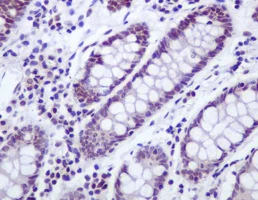 Immunohistochemistry (Formalin/PFA-fixed paraffin-embedded sections) - Anti-UBF1 antibody [EPR2742] (AB109011)