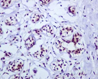 Immunohistochemistry (Formalin/PFA-fixed paraffin-embedded sections) - Anti-UBF1 antibody [EPR2742] (AB109011)