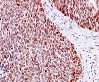 Immunohistochemistry (Formalin/PFA-fixed paraffin-embedded sections) - Anti-UBF1 (phospho S484) antibody [EPR2725(2)] (AB182583)