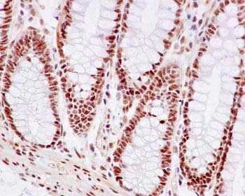 Immunohistochemistry (Formalin/PFA-fixed paraffin-embedded sections) - Anti-UBF1 (phospho S484) antibody [EPR2725(2)] - BSA and Azide free (AB250633)