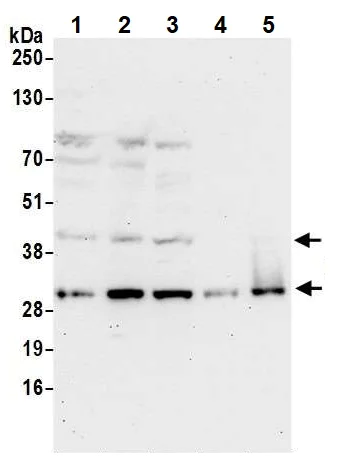 Western blot - Anti-UBFD1 antibody (AB240696)