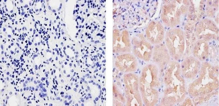 Immunohistochemistry (Formalin/PFA-fixed paraffin-embedded sections) - Anti-Ubiquilin/UBQLN1 antibody (AB3341)