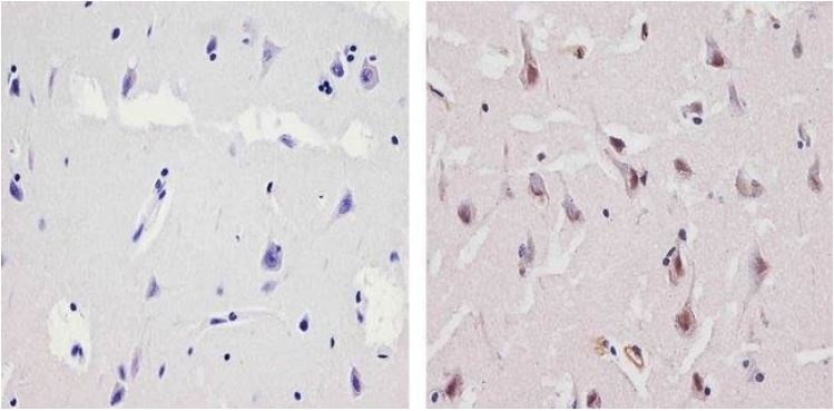 Immunohistochemistry (Formalin/PFA-fixed paraffin-embedded sections) - Anti-Ubiquilin/UBQLN1 antibody (AB3341)