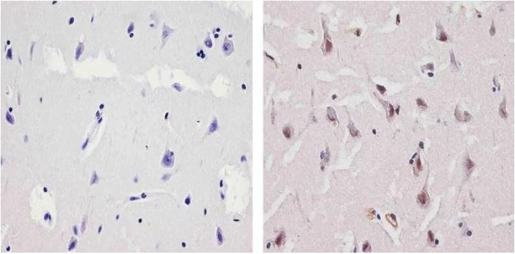 Immunohistochemistry (Formalin/PFA-fixed paraffin-embedded sections) - Anti-Ubiquilin/UBQLN1 antibody (AB3341)