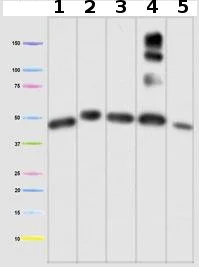 Western blot - Anti-Ubiquinol-Cytochrome C Reductase Core Protein I antibody [16D10AD9AH5] (AB110252)