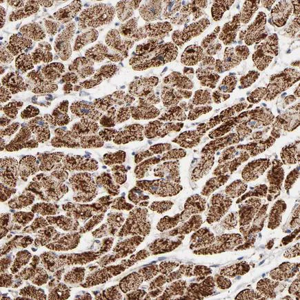 Immunohistochemistry (Formalin/PFA-fixed paraffin-embedded sections) - Anti-Ubiquinol-Cytochrome C Reductase Core Protein I antibody (AB223746)