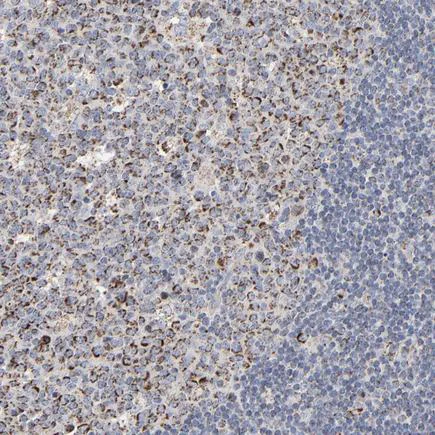 Immunohistochemistry (Formalin/PFA-fixed paraffin-embedded sections) - Anti-Ubiquinol-Cytochrome C Reductase Core Protein I antibody (AB223746)