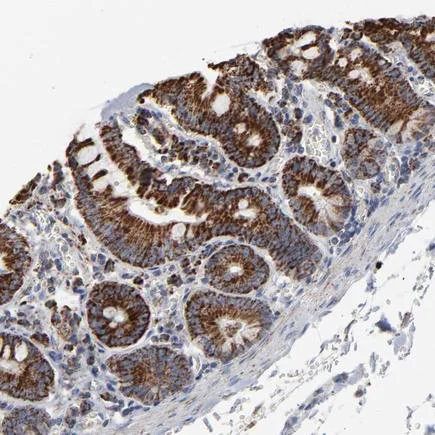Immunohistochemistry (Formalin/PFA-fixed paraffin-embedded sections) - Anti-Ubiquinol-Cytochrome C Reductase Core Protein I antibody (AB223746)
