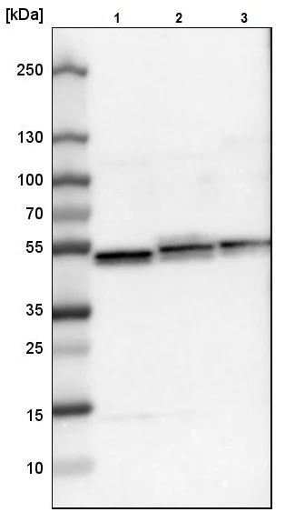 Western blot - Anti-Ubiquinol-Cytochrome C Reductase Core Protein I antibody (AB223746)