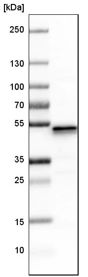 Western blot - Anti-Ubiquinol-Cytochrome C Reductase Core Protein I antibody (AB223746)