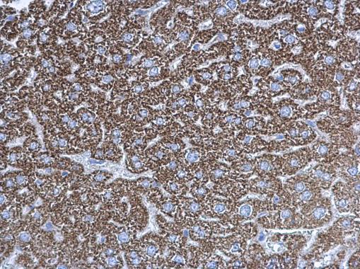 Immunohistochemistry (Formalin/PFA-fixed paraffin-embedded sections) - Anti-Ubiquinol-Cytochrome C Reductase Core Protein I antibody (AB96333), expandable thumbnail