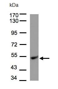 Western blot - Anti-Ubiquinol-Cytochrome C Reductase Core Protein I antibody (AB96333), expandable thumbnail