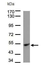 Western blot - Anti-Ubiquinol-Cytochrome C Reductase Core Protein I antibody (AB96333)