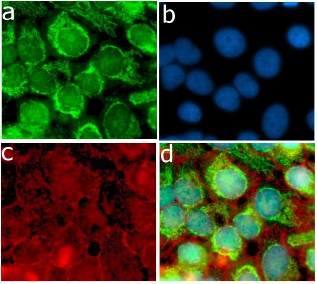 Immunocytochemistry - Anti-Ubiquitin antibody [10HCLC] (AB277768), expandable thumbnail