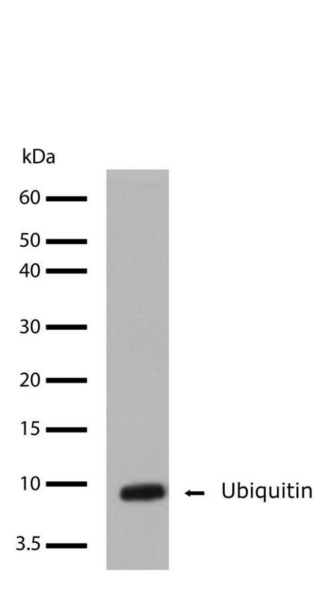 Western blot - Anti-Ubiquitin antibody [10HCLC] (AB277768), expandable thumbnail