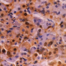 Immunohistochemistry (Formalin/PFA-fixed paraffin-embedded sections) - Anti-Ubiquitin antibody [1B4-UB] (AB122), expandable thumbnail