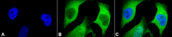 Immunocytochemistry/ Immunofluorescence - Anti-Ubiquitin antibody [5B9-B3] (AB223378), expandable thumbnail