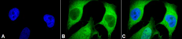 Immunocytochemistry/ Immunofluorescence - Anti-Ubiquitin antibody [5B9-B3] (AB223378)