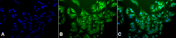 Immunocytochemistry/ Immunofluorescence - Anti-Ubiquitin antibody [5B9-B3] (AB223378), expandable thumbnail