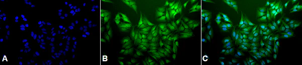 Immunocytochemistry/ Immunofluorescence - Anti-Ubiquitin antibody [5B9-B3] (AB223378)