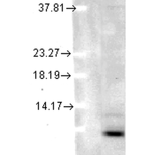 Western blot - Anti-Ubiquitin antibody [5B9-B3] (AB223378), expandable thumbnail