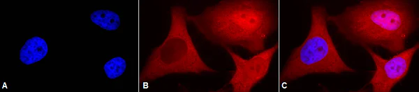 Immunocytochemistry/ Immunofluorescence - Anti-Ubiquitin antibody [6C11-B3] (AB223368)