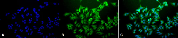 Immunocytochemistry/ Immunofluorescence - Anti-Ubiquitin antibody [6C11-B3] (AB223368)