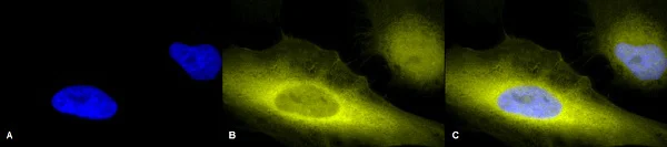 Immunocytochemistry/ Immunofluorescence - Anti-Ubiquitin antibody (AB223613)