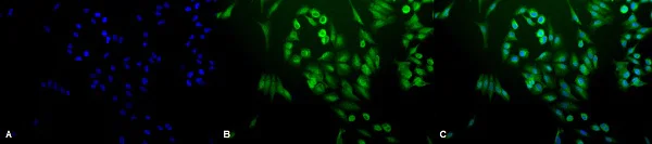 Immunocytochemistry/ Immunofluorescence - Anti-Ubiquitin antibody (AB223613)